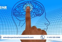 Global Neuronavigation Systems Market Size, Share, Outlook, Trends, Growth, Analysis, Forecast 2022-2027