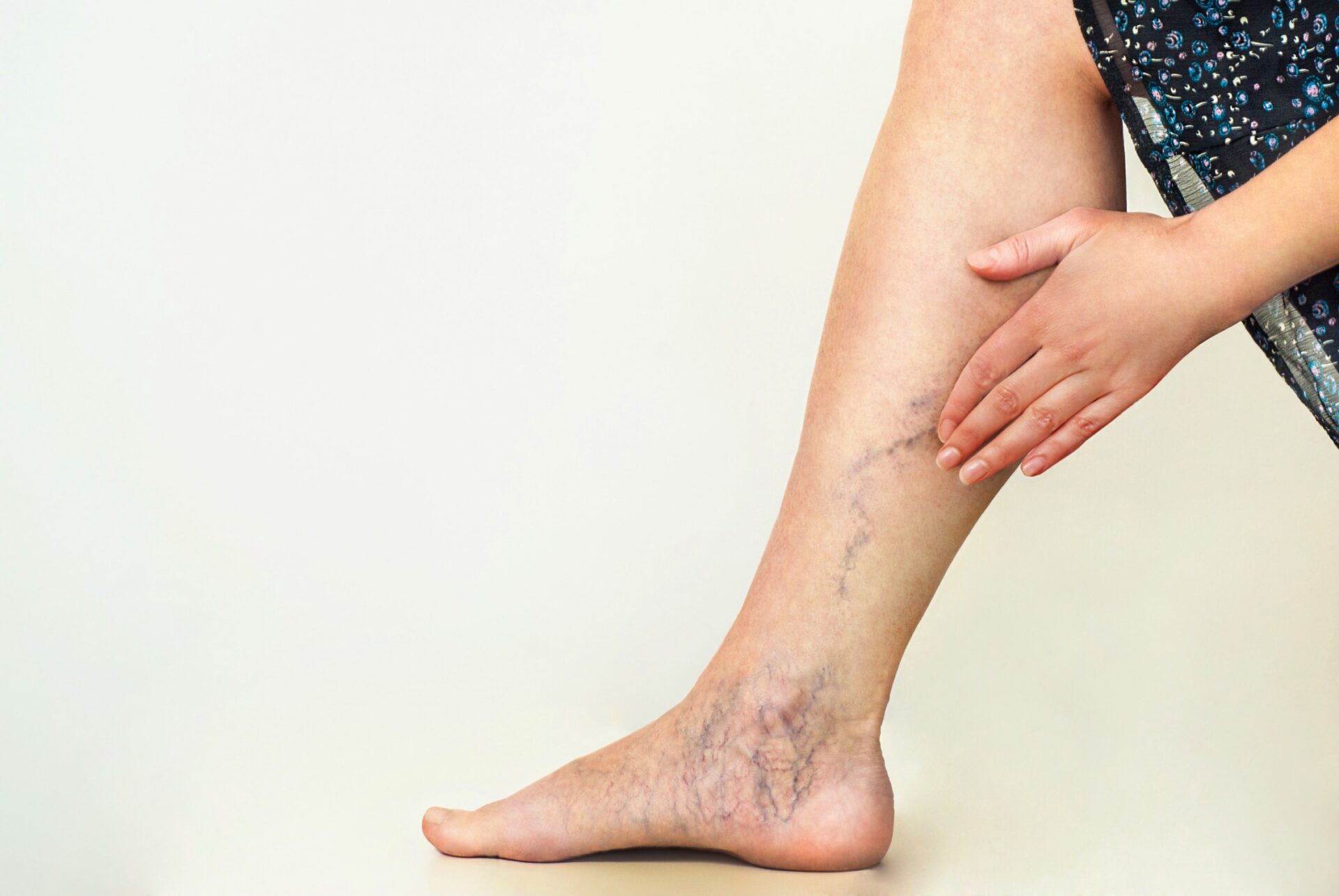 Understanding the different treatment options available for varicose veins in NJ