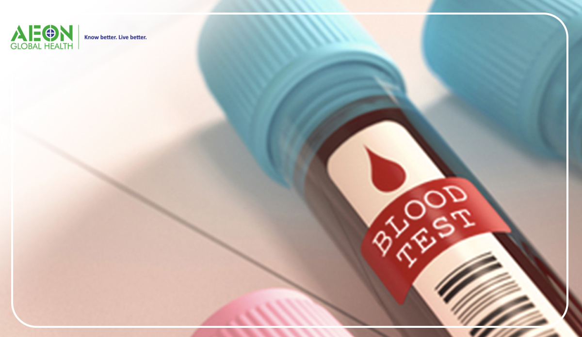 Best Services of GHP Blood Test in Gainesville