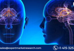 Global Huntington’s Disease Treatment Market Size To Grow At A CAGR Of 16% In The Forecast Period Of 2023-2031