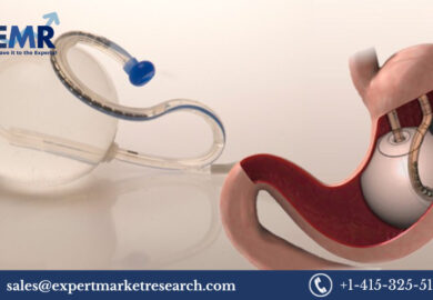 Global Intragastric Balloon Market Size, Share, Price, Trends, Report and Forecast 2023-2028