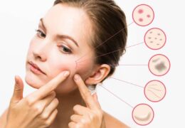 The Effective Solution: Acne and Pimple Patches for Cystic Acne