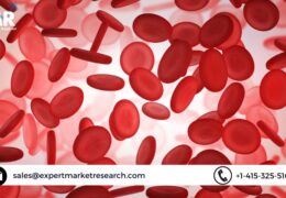 Global Cell Expansion Market Share, Price, Trends, Growth, Analysis, Report, Forecast 2023-2028