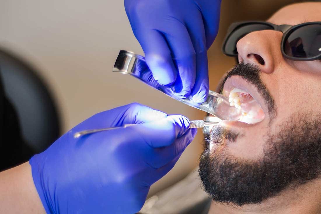 Emergency Dentist Services in Katy, Texas: Quick and Reliable Dental Care