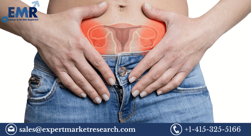 Ovarian Cancer Diagnostics And Therapeutics Market Size, Share, Trends, Analysis, Report and Forecast 2023-2028